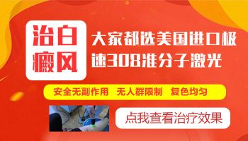 诊断治疗-白癜风的治疗时候主要注意什么